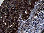 PIKFYVE Antibody in Immunohistochemistry (Paraffin) (IHC (P))