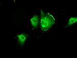 PIM2 Antibody in Immunocytochemistry (ICC/IF)