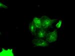 PIM2 Antibody in Immunocytochemistry (ICC/IF)