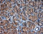 PIM2 Antibody in Immunohistochemistry (Paraffin) (IHC (P))