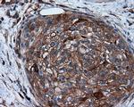 PIM2 Antibody in Immunohistochemistry (Paraffin) (IHC (P))