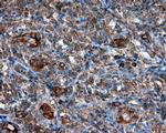 PIM2 Antibody in Immunohistochemistry (Paraffin) (IHC (P))