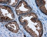 PIM2 Antibody in Immunohistochemistry (Paraffin) (IHC (P))