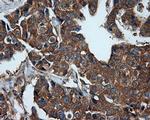 PIM2 Antibody in Immunohistochemistry (Paraffin) (IHC (P))