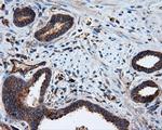 PIM2 Antibody in Immunohistochemistry (Paraffin) (IHC (P))