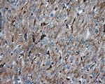 PIM2 Antibody in Immunohistochemistry (Paraffin) (IHC (P))