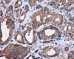 PIM2 Antibody in Immunohistochemistry (Paraffin) (IHC (P))