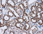 PIM2 Antibody in Immunohistochemistry (Paraffin) (IHC (P))