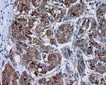 PIM2 Antibody in Immunohistochemistry (Paraffin) (IHC (P))