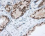 PIM2 Antibody in Immunohistochemistry (Paraffin) (IHC (P))