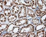 PIM2 Antibody in Immunohistochemistry (Paraffin) (IHC (P))