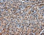 PIM2 Antibody in Immunohistochemistry (Paraffin) (IHC (P))