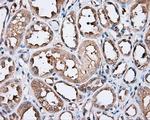 PIM2 Antibody in Immunohistochemistry (Paraffin) (IHC (P))