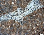 PIM2 Antibody in Immunohistochemistry (Paraffin) (IHC (P))