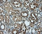 PIM2 Antibody in Immunohistochemistry (Paraffin) (IHC (P))