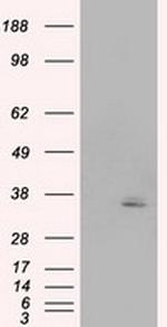 PIM2 Antibody in Western Blot (WB)