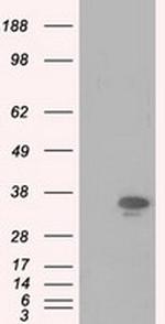 PIM2 Antibody in Western Blot (WB)