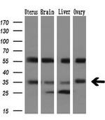 PIM2 Antibody in Western Blot (WB)