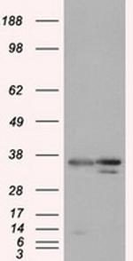 PIM2 Antibody in Western Blot (WB)