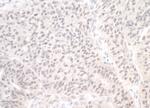 CDC20 Antibody in Immunohistochemistry (IHC)