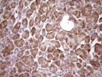 PIN4 Antibody in Immunohistochemistry (Paraffin) (IHC (P))