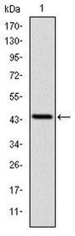 LIMS1 Antibody in Western Blot (WB)