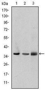 LIMS1 Antibody in Western Blot (WB)