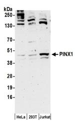 PINX1 Antibody in Western Blot (WB)