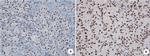 EZH2 Antibody in Immunohistochemistry (Paraffin) (IHC (P))