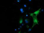 PIP4K2A Antibody in Immunocytochemistry (ICC/IF)