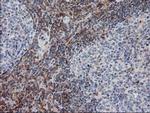 PIP4K2A Antibody in Immunohistochemistry (Paraffin) (IHC (P))