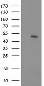 PIP4K2A Antibody in Western Blot (WB)