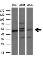 PIP4K2A Antibody in Western Blot (WB)