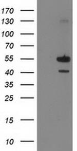 PIP4K2A Antibody in Western Blot (WB)