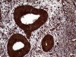 PITPNB Antibody in Immunohistochemistry (Paraffin) (IHC (P))