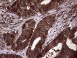 PITPNB Antibody in Immunohistochemistry (Paraffin) (IHC (P))