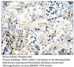 Phospho-JAK1 (Tyr1034, Tyr1035) Antibody in Immunohistochemistry (IHC)