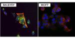 PKC alpha Antibody in Immunocytochemistry (ICC/IF)