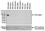 PKC alpha Antibody in Western Blot (WB)