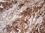 PKM1 Antibody in Immunohistochemistry (Paraffin) (IHC (P))