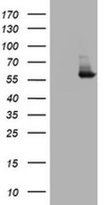 PKM1 Antibody in Western Blot (WB)