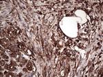 PKM2 Antibody in Immunohistochemistry (Paraffin) (IHC (P))