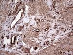 PKM2 Antibody in Immunohistochemistry (Paraffin) (IHC (P))