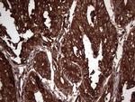 PKM2 Antibody in Immunohistochemistry (Paraffin) (IHC (P))