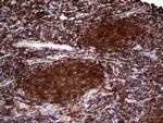 PKM2 Antibody in Immunohistochemistry (Paraffin) (IHC (P))