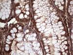 PKM2 Antibody in Immunohistochemistry (Paraffin) (IHC (P))