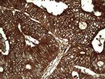 PKM2 Antibody in Immunohistochemistry (Paraffin) (IHC (P))