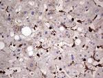 PKM2 Antibody in Immunohistochemistry (Paraffin) (IHC (P))