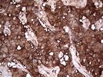 PKM2 Antibody in Immunohistochemistry (Paraffin) (IHC (P))