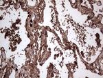 PKM2 Antibody in Immunohistochemistry (Paraffin) (IHC (P))